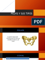 7 Pelvis y Sus Tipos