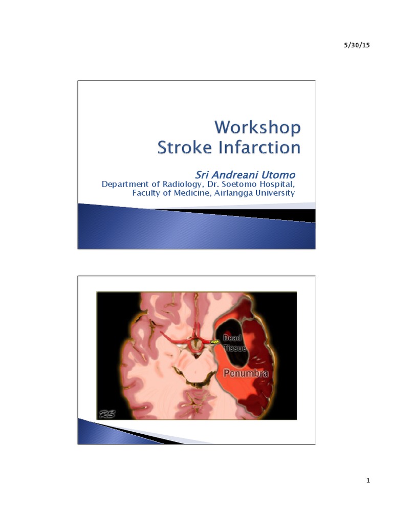 Workshop Stroke Infarction1 Pdf Stroke Ct Scan