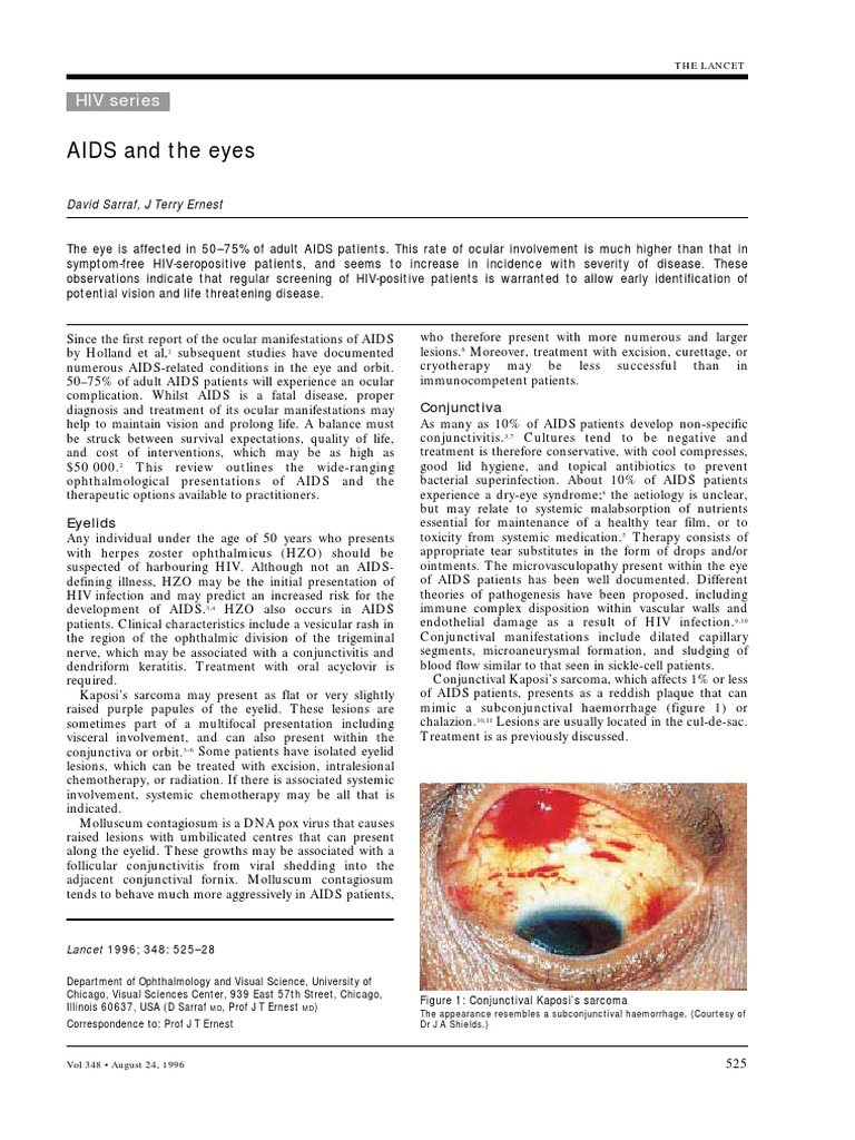 AIDS and The Eyes: HIV Series | PDF | Hiv/Aids | Epidemiology