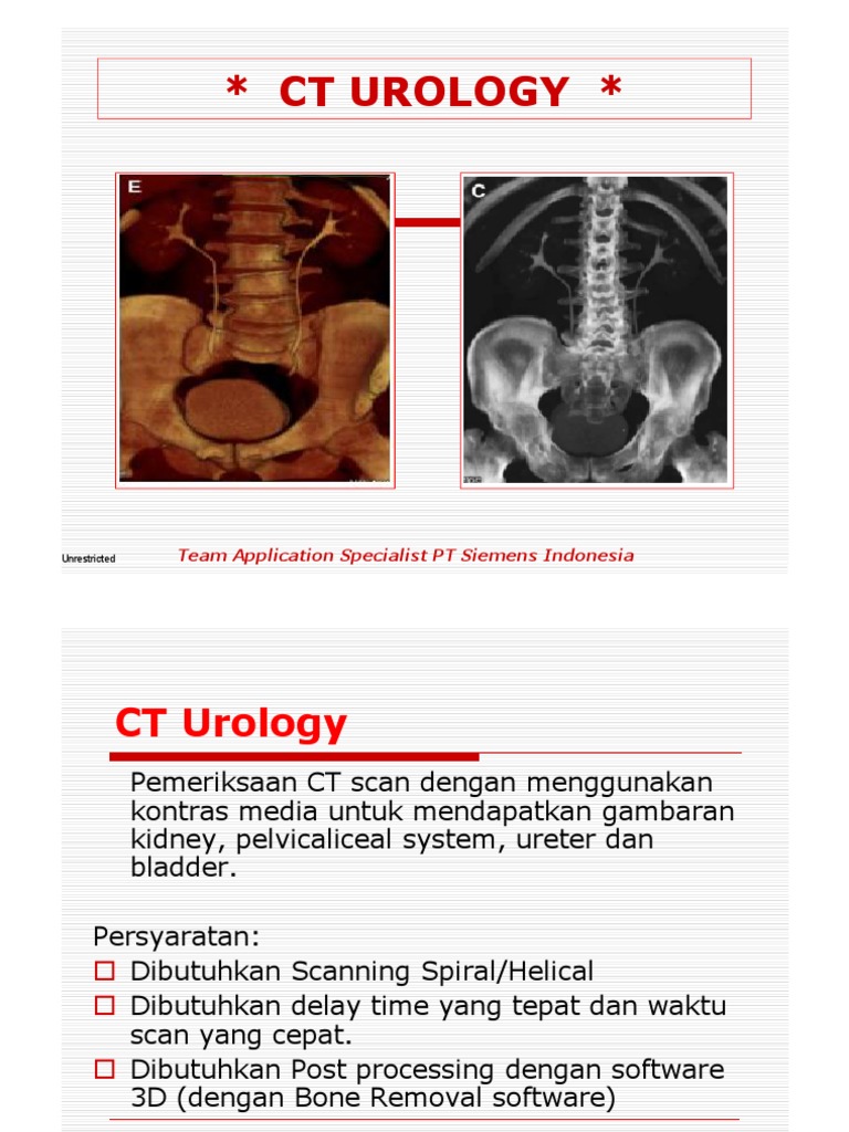 Prosedur dan Manfaat CT Urologi | PDF