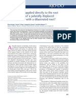 Can Forces Be Applied Directly To The Root For Correction of A Palatally Displaced Central Incisor With A Dilacerated Root?