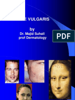 Acne Vulgaris By: Dr. Majid Suhail Prof Dermatology