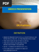 Download Breech Presentation by Prathibha Guruguri SN42937936 doc pdf