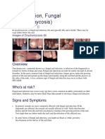 Nail Infection, Fungal (Onychomycosis)