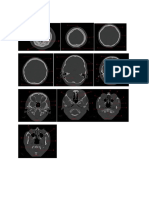 CT Scan Brain Print