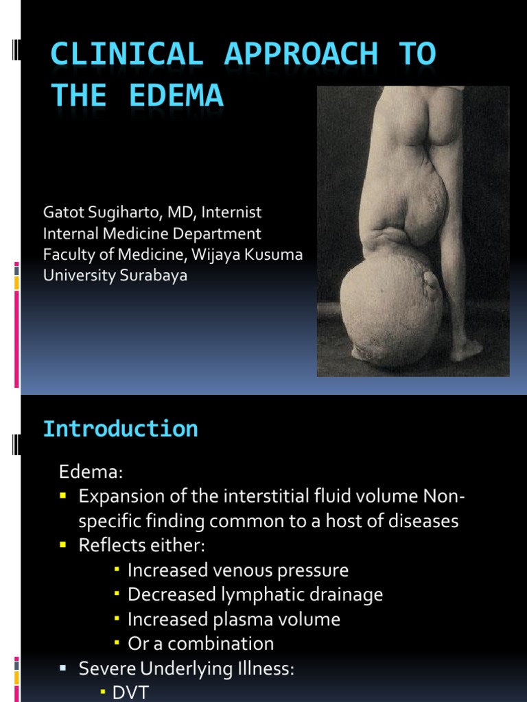 Clinical Approach To The Edema | PDF | Edema | Heart Failure