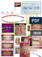 tipos de dentaduras.docx