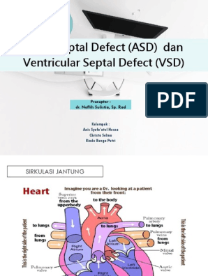 Adalah asd jantung Defek Septum