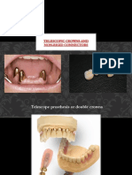 Telescopic Crowns and Non-Rigid Connectors