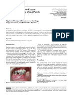 Novel Technique To Expose Impacted Canine Using Punch Biopsy Instrument