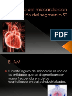 Infarto del miocardio con elevación del segmento ST (STEMI