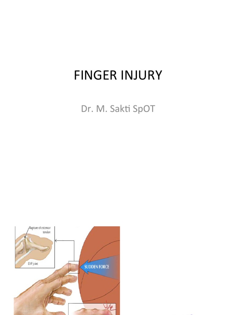 Finger Tip Injury PDF Surgical Specialties Musculoskeletal System