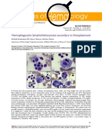 Hemophagocytic Lymphohistiocytosis Secondary To Histoplasmosis