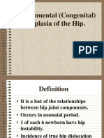 Developmental (Congenital) Dysplasia of The Hip