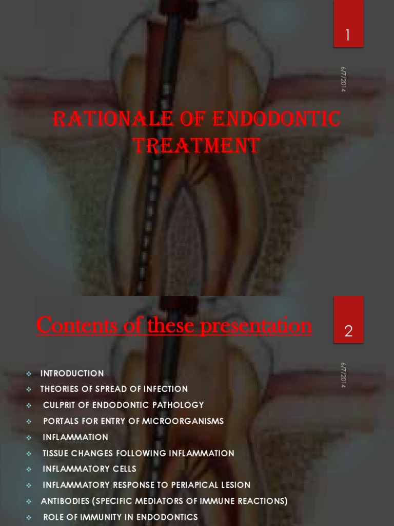 Rationale of Endodontic Treatment PDF Immune System Inflammation