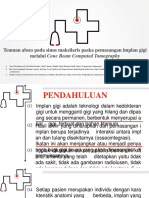 Temuan Abses Pada Sinus Maksilaris Paska Pemasangan Implan Gigi Melalui CBCT