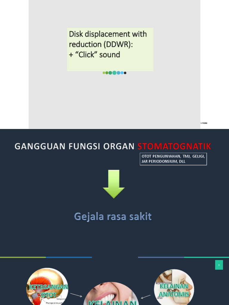 Disc Displacement With Reduction (DDWR) | PDF | Sains & Matematika