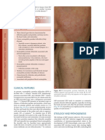 Fitzpatrick - Folliculitis