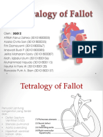 SGD 2 Tetralogy of Fallot