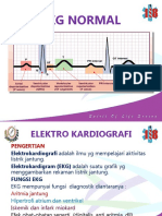 Chapter 17 EKG Normal 17