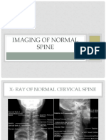 Imaging of Normal Spine