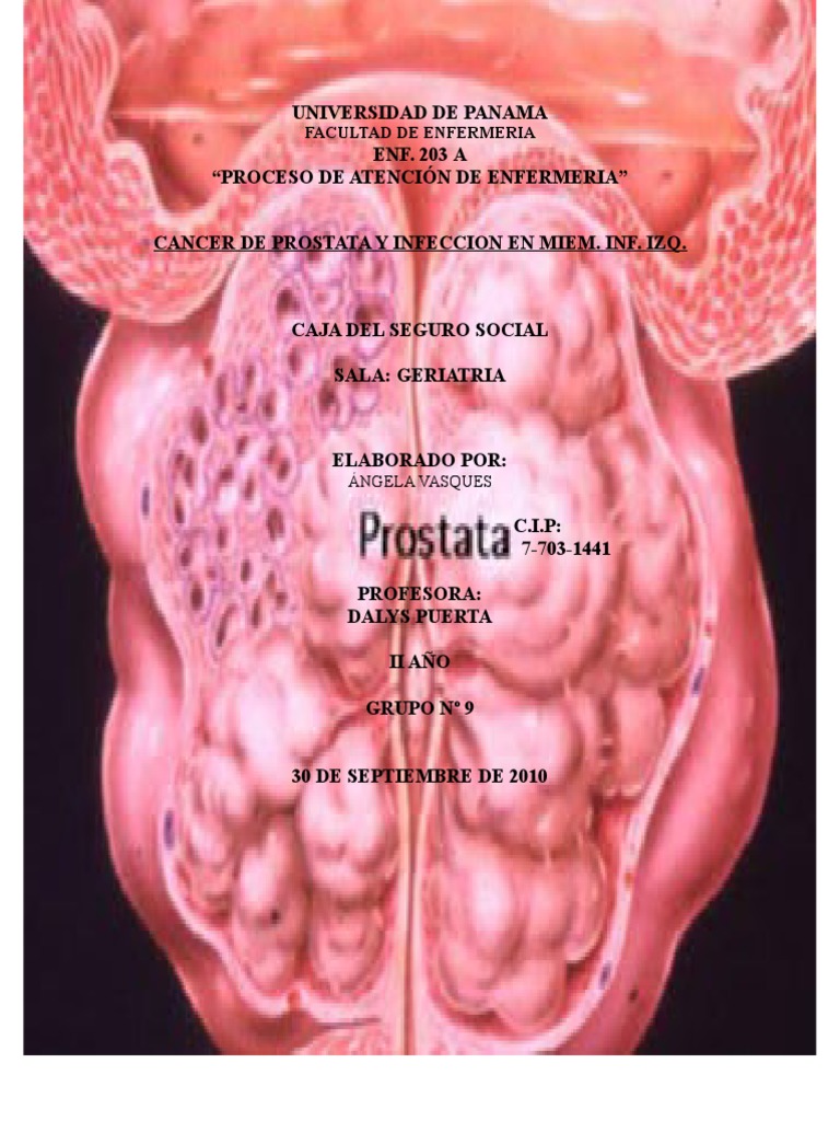 doxiciclina para prostata