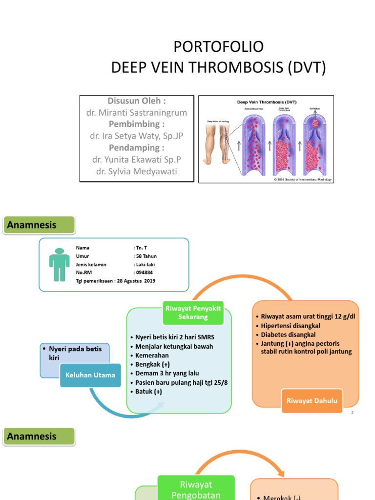 Penanganan Trombosis Vena Dalam (DVT) | PDF