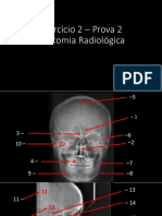 Exercício 2 P2-Anatomia Rad. CRÂNIO