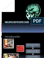 neurocisticercosis