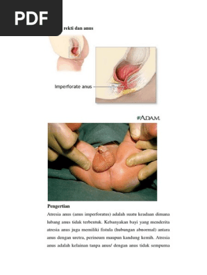 Qishda ormonda jinsiy aloqa, peeping