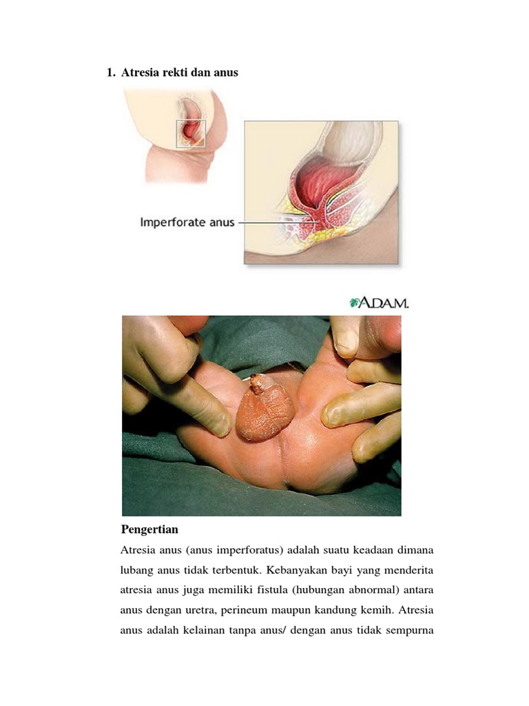 Jimmi Neytron va Sindi jinsiy aloqa