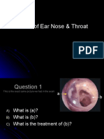 OSCE of Ear Nose & Throat