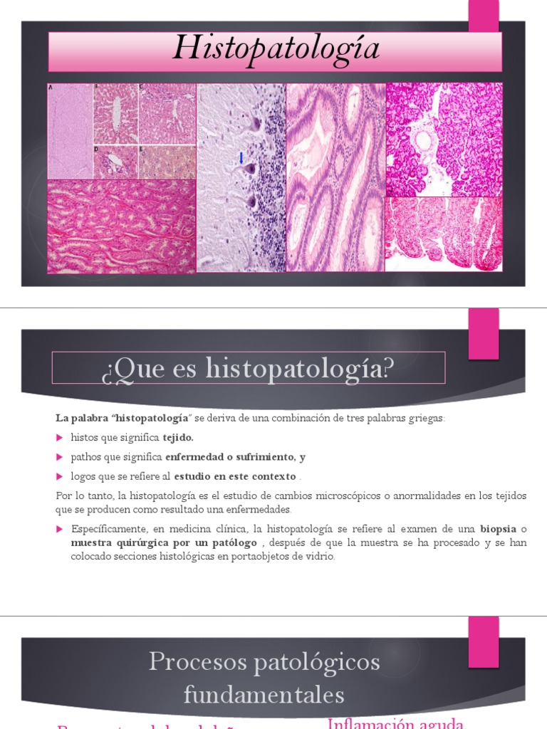 Histopatología PDF Neoplasias Ciencias de la Salud