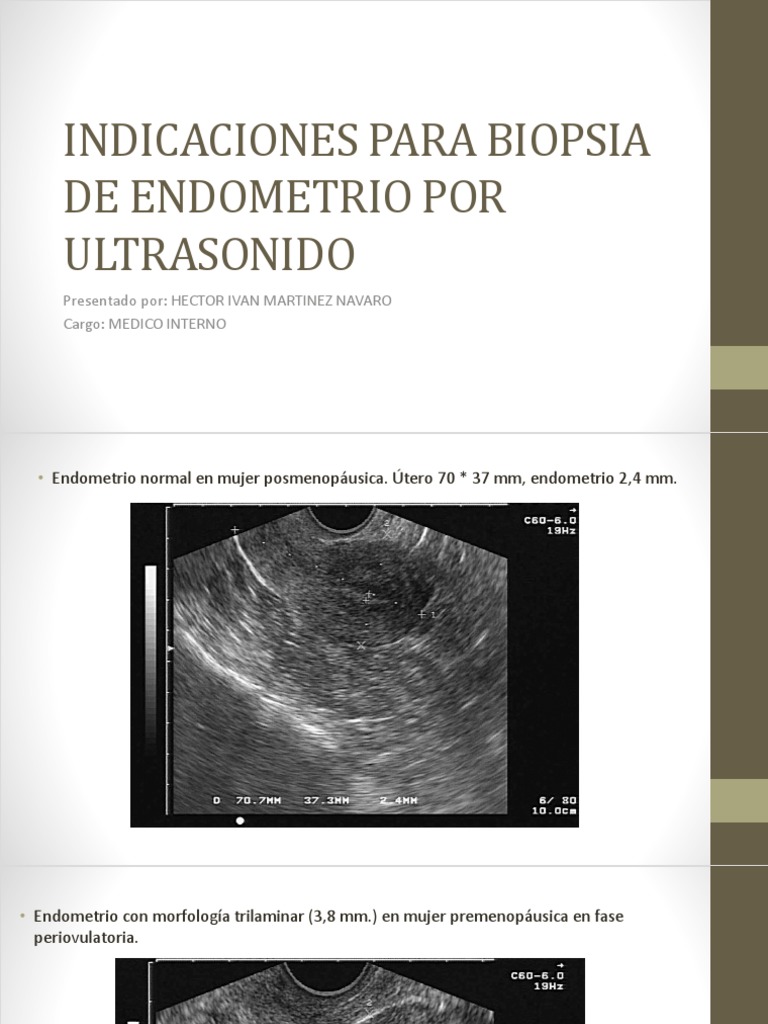 Indicaciones Biopsia Endometrio Ultrasonido | PDF | Ultrasonido médico ...