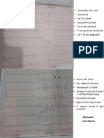 EKG Intan