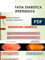 Retinopatía Diabética