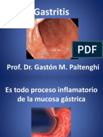 Gastritis