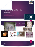 Enfermedad Ocular Tiroidea (TED)