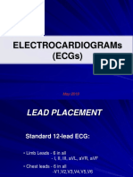 Electrocardiograms (Ecgs)