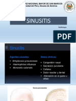 SINUSITIS Radiologia