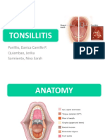 Tonsillitis: Panlilio, Danica Camille P. Quiambao, Jerika Sarmiento, Nina Sarah