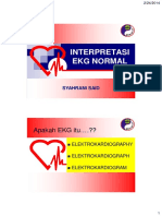 Ekg