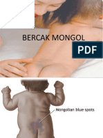 Bercak Mongol 
