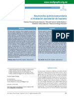 Neumonitis Quimica