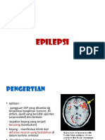 Epilepsi