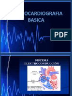 ekg