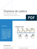 Displasia de Cadera