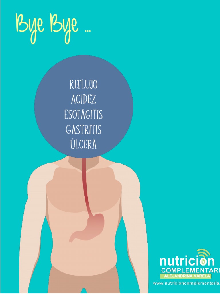 Acidez Gástrica PDF Acidez Estómago
