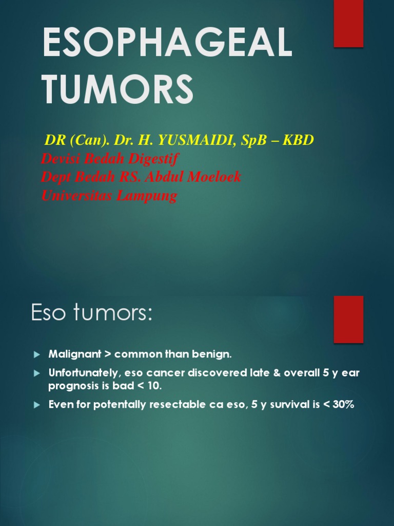 Esophageal Tumors: Types and Treatment | PDF | Esophageal Cancer ...