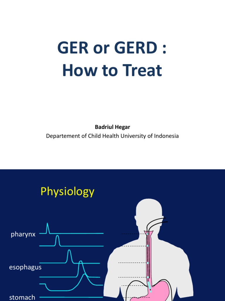 Pediatric GERD Treatment Guidelines | PDF | Gastroesophageal Reflux ...